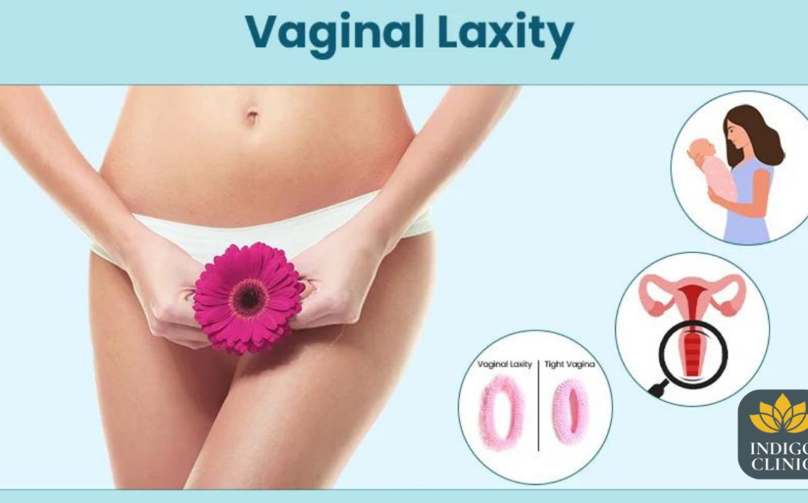 Unlocking the Secrets of Vaginal Laxity: Reclaiming Your Confidence and Intimacy